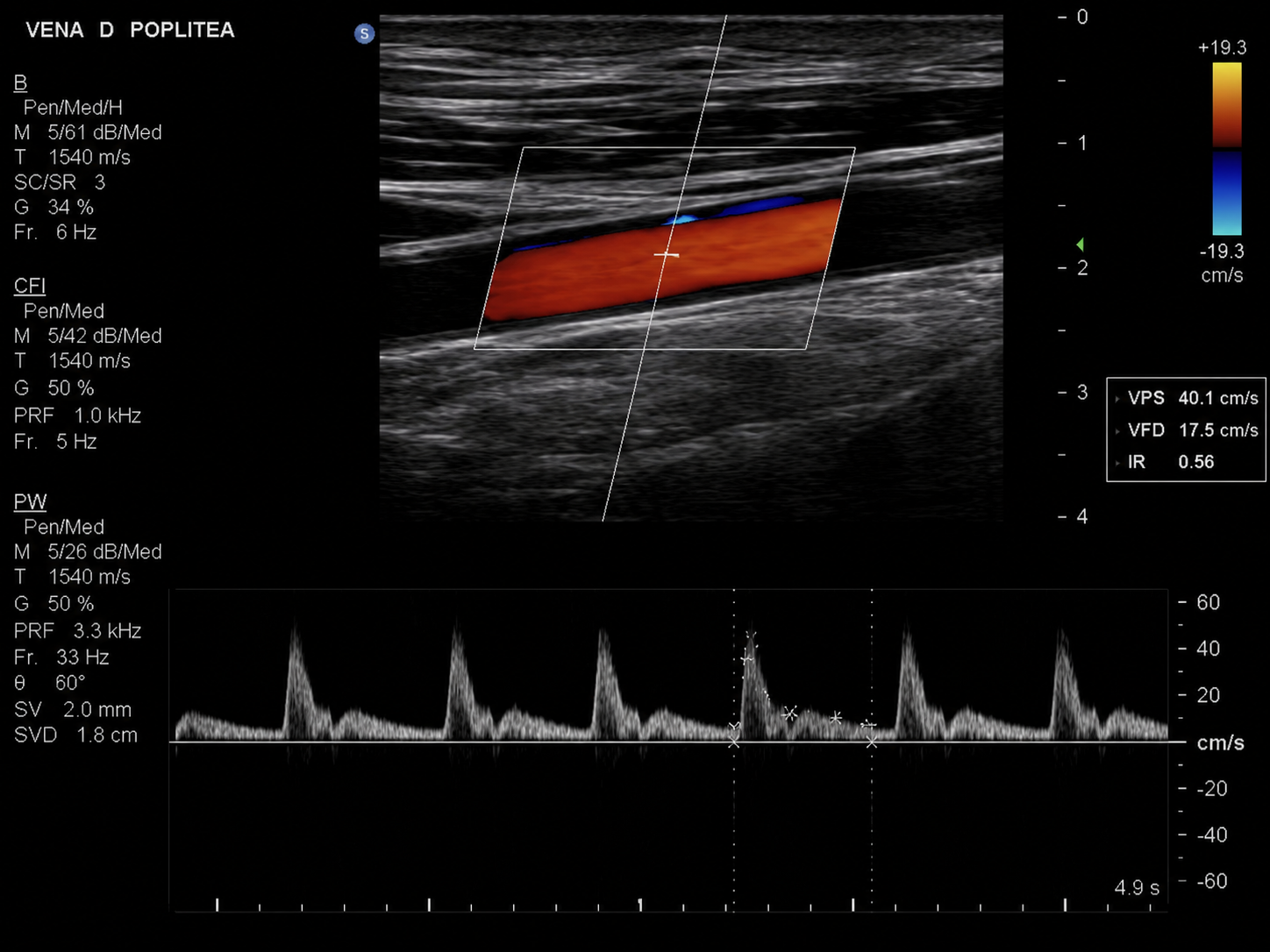 Estudio Doppler Vascular Periférico